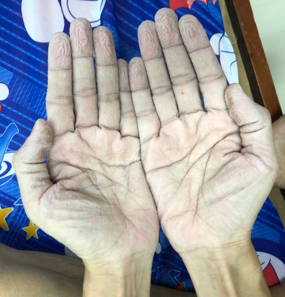 Cuộc chiến chống COVID-19 trong “chảo lửa” Phước Lộc: Những ám ảnh sống còn -0