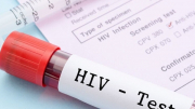 Bộ Y tế vào cuộc vụ tự ý lấy máu của học sinh để xét nghiệm HIV