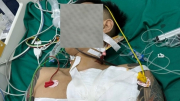 Mâu thuẫn bán hàng, chủ quán cà phê cầm dao chém "đối thủ"