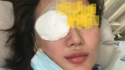 Khởi tố nam thanh niên đánh bạn gái gây thương tích