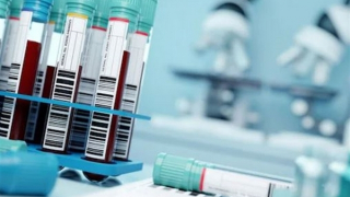 Nga cảnh báo một virus nguy hiểm lây lan mùa Thu tới