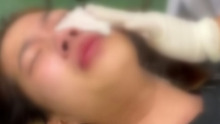 Triệu tập đối tượng xịt hơi cay bỏng mặt nữ sinh