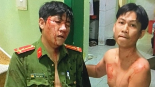 Cảnh sát khu vực bị "con nghiện" tấn công gây thương tích nặng