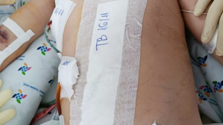 Hơn 1,5 tháng nỗ lực cứu bé trai bị đa chấn thương nguy kịch