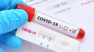 Khai báo giá test COVID PCR từ 96-150 nghìn đồng/test, bán 250 - 395 nghìn đồng/test