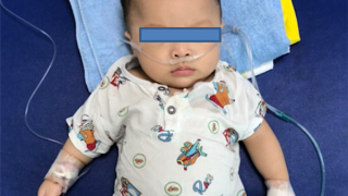 Vì nhiễm COVID-19, bệnh nhi mắc bệnh hiếm gặp của thế giới