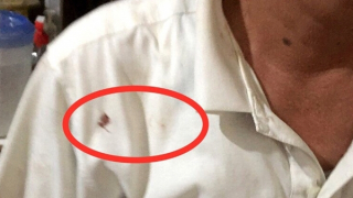 Linh tính của người cảnh sát khu vực trước vết máu trên áo kẻ thủ ác giấu mặt