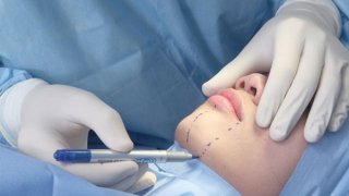 Chết oan vì... làm đẹp