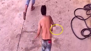 Đối tượng dùng kéo đâm nhân viên cây xăng có biểu hiện tâm thần