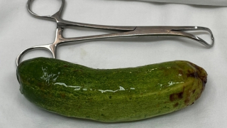 Lấy dị vật "khủng" trong hậu môn nam thanh niên thích cảm giác lạ