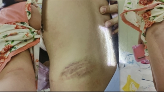 Đừng bắt những đứa trẻ phải tự chống đỡ