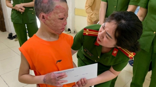 Trao quà cho các bệnh nhi nặng tại Bệnh viện Bỏng Quốc gia Lê Hữu Trác