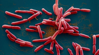 Đắk Lắk ghi nhận bé gái mắc bệnh Whitmore