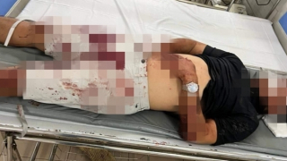 Bị đánh hội đồng sau khi mâu thuẫn với nữ nhân viên quán karaoke