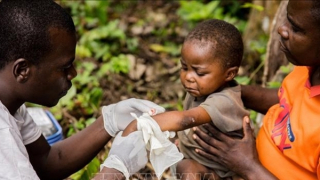 Bệnh đậu mùa khỉ, một lịch sử kỳ lạ ít người biết