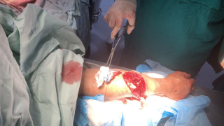 Bị hàng xóm dùng dao đâm chém, 1 người chết, 2 người nguy kịch