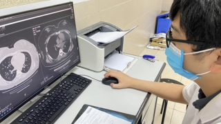 Nhiều bệnh nhân hậu COVID-19 bị hoại tử, tiêu xương vùng mặt