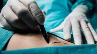 Môi giới bán thận để hưởng lợi, nam thanh niên bị xét xử 3 tội danh