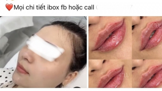 Làm đẹp trên mạng – Coi chừng tiền mất, tật mang