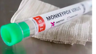 Xây dựng kịch bản, tổ chức diễn tập, sẵn sàng đáp ứng với bệnh đậu mùa khỉ