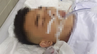 Bắt nhóm côn đồ nổ súng khiến một người trọng thương