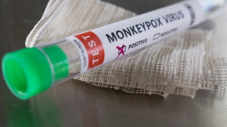 WHO tìm tên thay thế cho "đậu mùa khỉ"