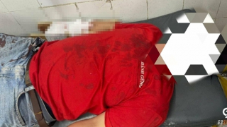 Mâu thuẫn với nhân viên quán karaoke, khách bị chém gần lìa cánh tay