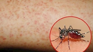 Đồng Tháp có 8.425 ca mắc sốt xuất huyết