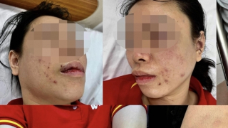 7m cn-62 hôm sau đánh 41-45 - đánh nhẹ cửa sau _ cm88.host Chiến lược tối ưu dự đoán và quản lý rủi ro dành cho dân chơi lô đề