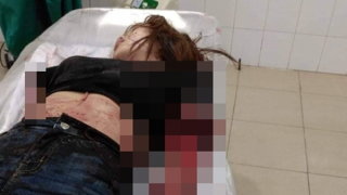 Chém đứt lìa 2 cánh tay vợ do bị người tình của vợ khiêu khích, kích động?