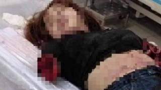 Chồng máu lạnh chém đứt lìa 2 cánh tay vợ