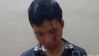 Bôi tiết lợn lên mặt giả bị bắt cóc, đánh đập để tống tiền mẹ đẻ