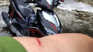 Một cán bộ Công an bị đối tượng ma túy tấn công gây thương tích