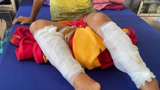 Cha ruột trói con rồi dùng xăng đốt chân