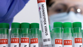 Có cần thiết phải tiêm vaccine đậu mùa khỉ?