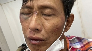 Đối tượng nhiễm HIV gây trọng án, cầm rìu chống trả khi bị vây bắt