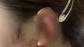 Công an vào cuộc vụ đạp vỡ kính ô tô, cắn đứt tai “tình địch”