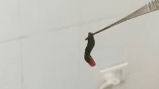 Xử lý thành công con vắt dài hơn 2 cm trong hốc mũi bệnh nhân