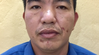 Mạo danh là Công an, lừa nhận tiền của gia đình bệnh nhân "chạy" mổ sớm