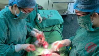 Hy hữu: Mổ bắt con cho sản phụ mang thai đôi ở hai tử cung khác nhau