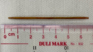 Bị thủng ruột non vì đi ngủ vẫn ngậm tăm