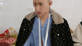 Dập nát bàn tay do pháo tự chế phát nổ