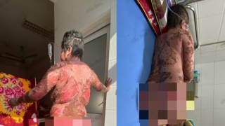 Thêm bệnh nhân suýt mất mạng vì uống thuốc nam chữa đau khớp