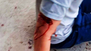 Du khách bị chó tấn công khi đang tản bộ tại phố biển Nha Trang