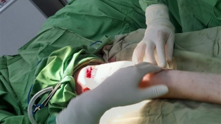 Từ vụ chó “vồ” du khách, Nha Trang tính lập đội săn bắt chó thả rông