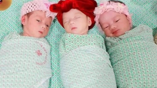 (Hy hữu) Ca sinh 3 tự nhiên cùng trứng hiếm gặp