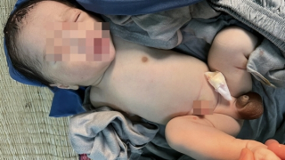 Bé trai sơ sinh nặng 3kg bị bỏ rơi