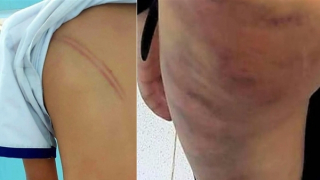 Khởi tố vụ án mẹ kế đánh con chồng