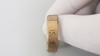 Thanh niên 27 tuổi suýt bị hoại tử "của quý" vì đeo nhẫn tạo khoái cảm