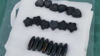 Bé trai 10 tuổi nuốt 20 viên nam châm vì nghĩ là kẹo